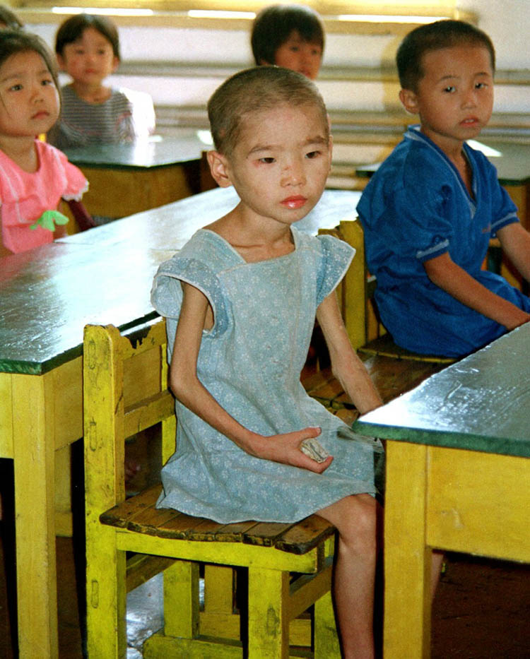 La desnutrición infantil en Corea del Norte reflejada en una fotografía