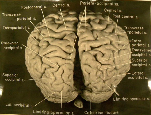 Cerebro de Albert Einstein