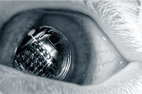 Una nueva generación de lentillas promete cambiar la forma en que vemos el mundo Una nueva generación de lentillas promete cambiar la forma en que vemos el mundo