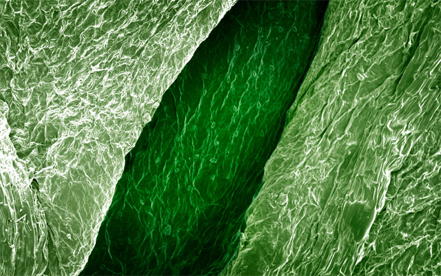 Hoja de apio con un microscopio electrónico de barrido