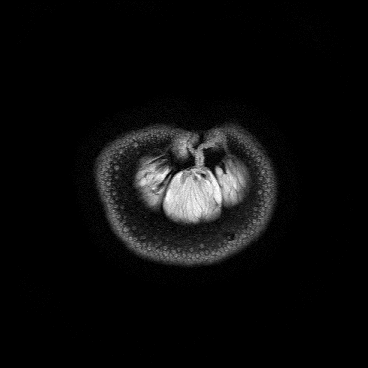 Imagen por resonancia magnética de una naranja